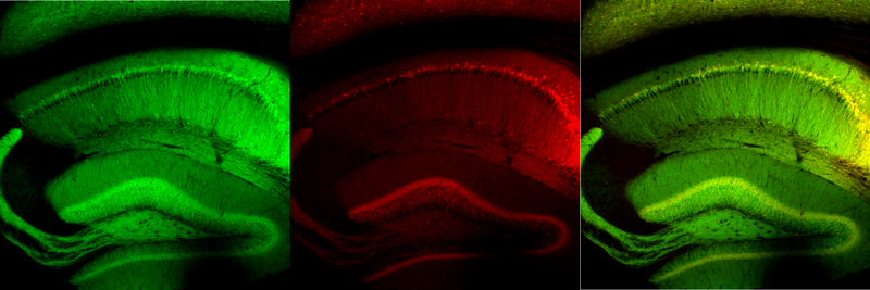 ファイル:Thy1-hippocampus-merge.png